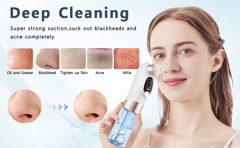 Remover Pore Vacuum Face Cleaner