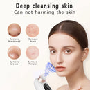 Remover Pore Vacuum Face Cleaner