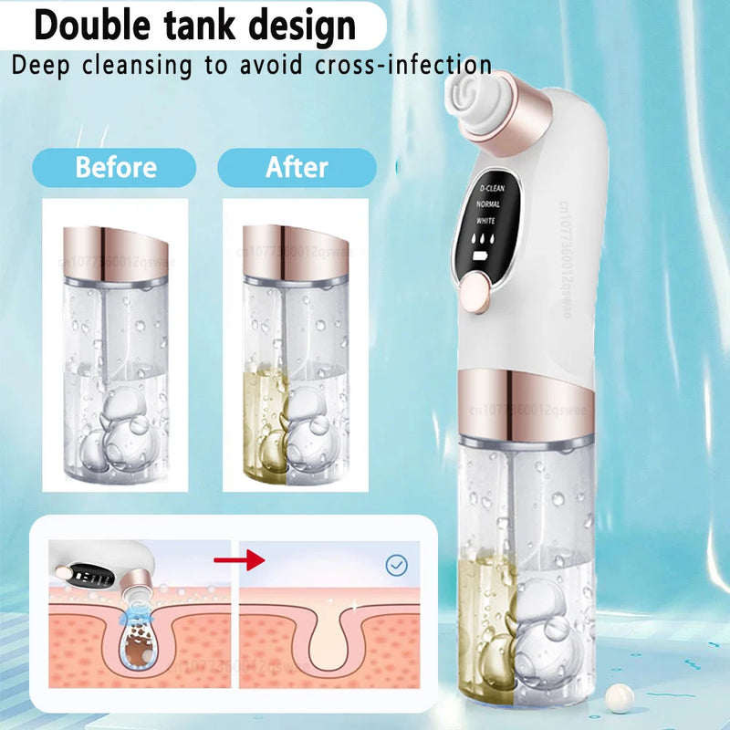 Remover Pore Vacuum Face Cleaner