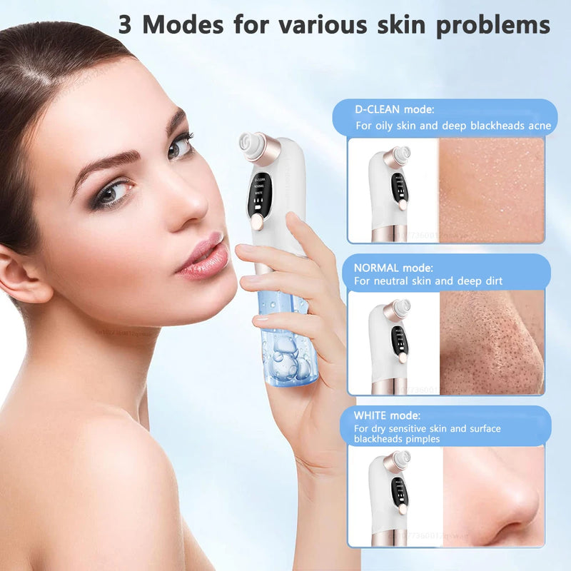 Remover Pore Vacuum Face Cleaner
