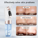 Remover Pore Vacuum Face Cleaner